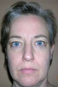 Sun Cancer Moon Cancer Asc Cancer